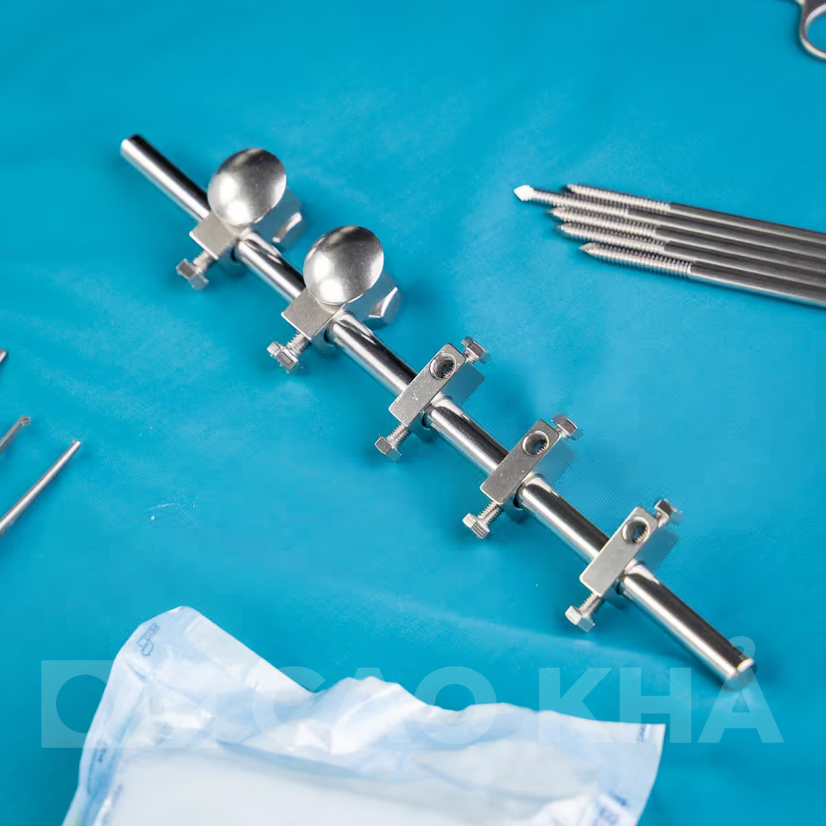 Cố định ngoài Liên mấu chuyển - góc nhìn 2